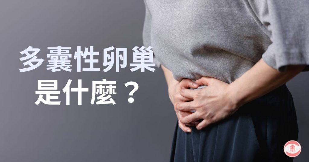 多囊性卵巢
