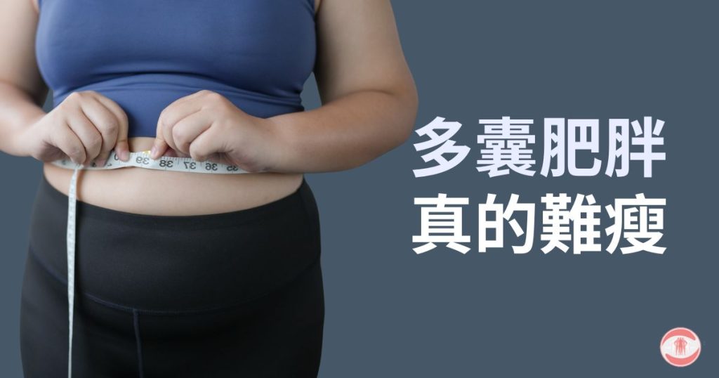 多囊肥胖