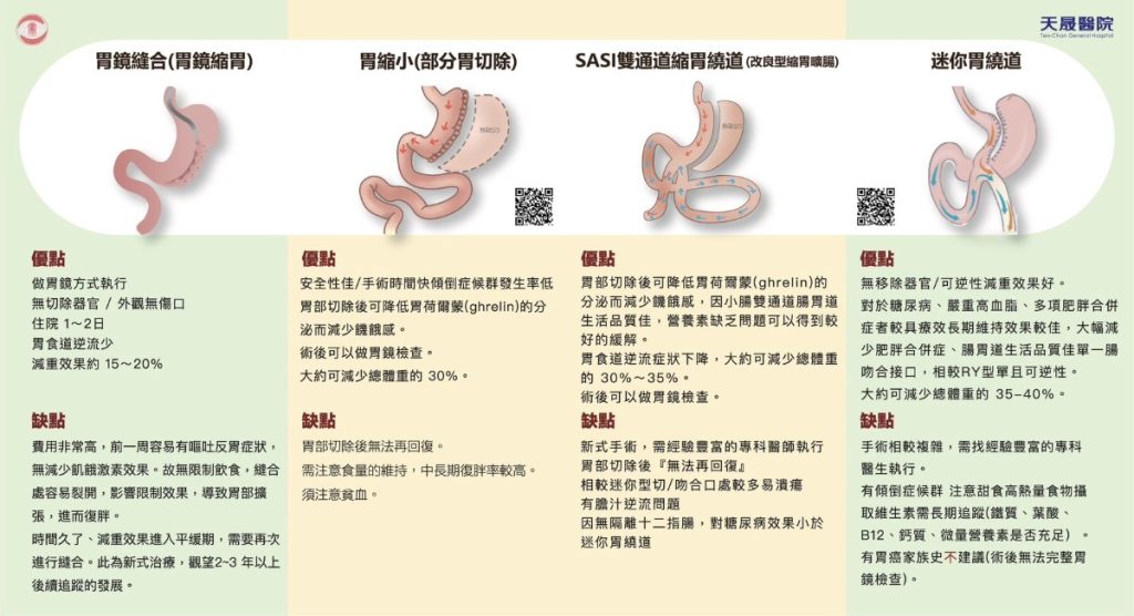 減重手術比較圖