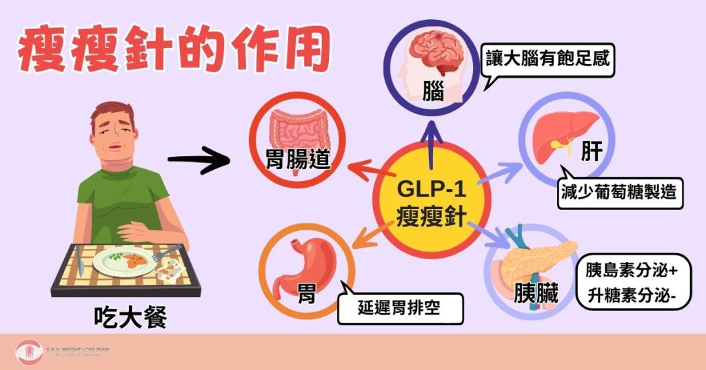聚餐後體重飆升怎麼瘦最快?瘦瘦針與減重手術效果全面比拼 2 瘦瘦針