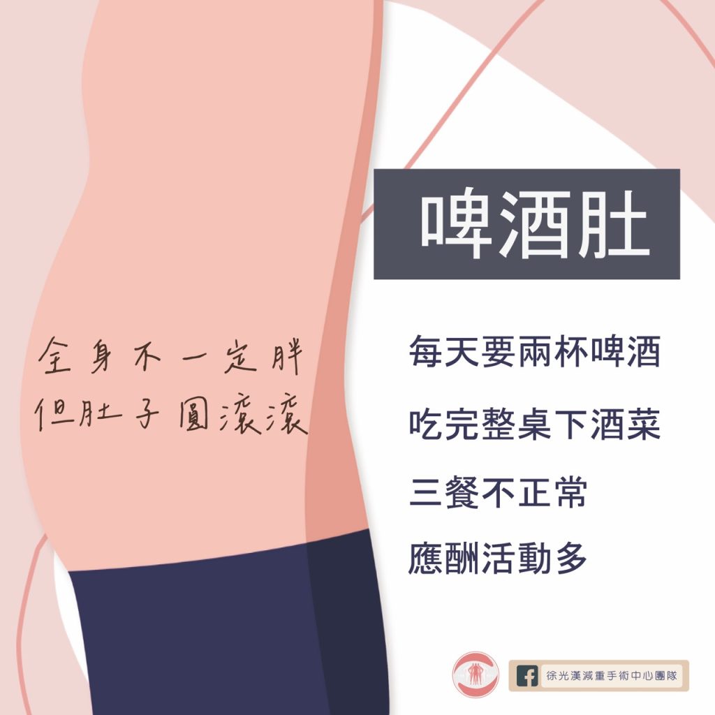 你是哪種「腹」爸爸?你也有大肚腩困擾嗎? 5 啤酒肚