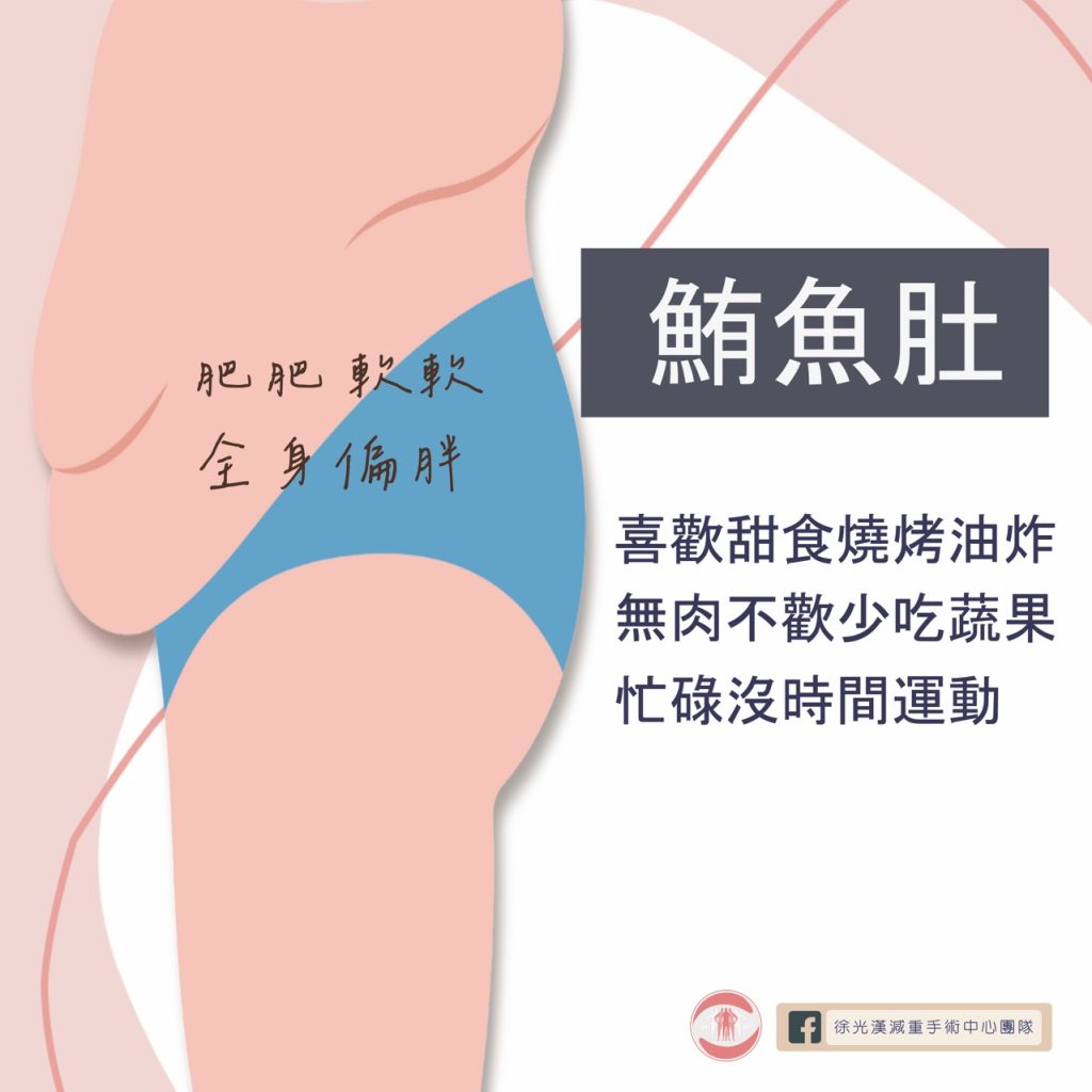 你是哪種「腹」爸爸?你也有大肚腩困擾嗎? 1 鮪魚肚